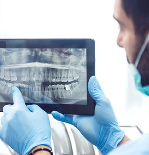 Goodyear dentist pointing to X-ray after tooth extraction