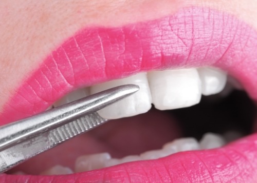 woman in the dental chair holding veneers up to her smile